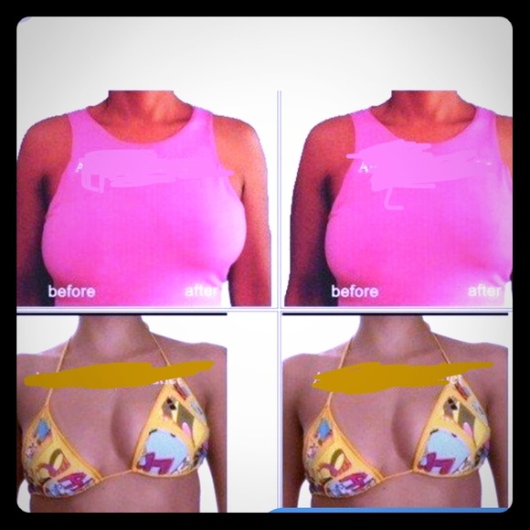 🆕BareLifts Instant BreastLift Tape - Picture 3 of 5